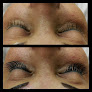 Affinity Day Spa And Permanent Cosmetics Laser Tattoo Removal