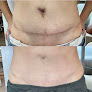 Arch Angels Nj Permanent Make Up Studio Laser Tattoo Removal