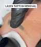 Beneath The Surface Skin Studio Laser Tattoo Removal
