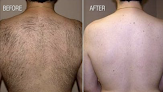 Christina Studio Spa & Chr Academy Laser Tattoo Removal