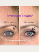 Cosmetic Solutions Laser Tattoo Removal