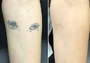 Delete Ink Laser Aesthetics Laser Tattoo Removal