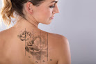 Dermapro Med Spa Laser Tattoo Removal