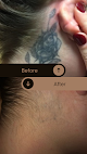 Disappearing Ink/ Jill & Bonnie's Hair Removal And Skin Clinic/ The Finished Line Permanent Cosmetics Laser Tattoo Removal