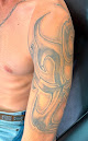 Doral Laser Tattoo Removal Laser Tattoo Removal