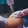 Electrolysis By Linda Laser Tattoo Removal
