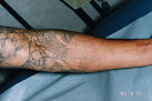 Erase The Canvas Laser Tattoo Removal