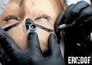 Ero Edge Laser Tattoo Removal