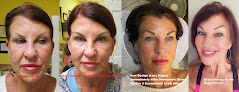 Exceptional Ever After Permanent Cosmetics & Skin Care Laser Tattoo Removal