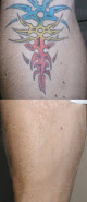 Fabulously Flawless Permanent Cosmetics And Aesthetics Laser Tattoo Removal