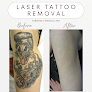 Farghaly Medical Spa Laser Tattoo Removal
