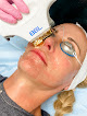 Florida Aesthetics And Wellness Laser Tattoo Removal