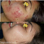 Highbrow Cosmetic Tattoo Laser Tattoo Removal