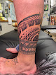 Ink Spot Laser Tattoo Removal
