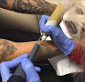 Inkoff Laser Tattoo Removal