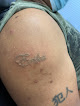 Ko Blade & Beauty Laser Tattoo Removal
