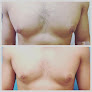 La Piel Perfecta Laser Center Laser Tattoo Removal