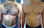 Laser And Cosmetic Center Laser Tattoo Removal