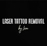 Laser Tattoo Removal By Lena Laser Tattoo Removal