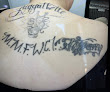 Laseraway Brea Laser Tattoo Removal