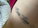 Laseraway Brooklyn Heights Laser Tattoo Removal