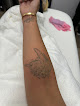 Laseraway Evanston Laser Tattoo Removal