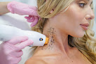 Laseraway Madison Laser Tattoo Removal
