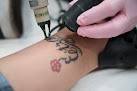 Laseraway Sugar Land Laser Tattoo Removal