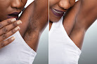 Laserhere Laser Tattoo Removal