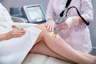 Laserhere Laser Tattoo Removal