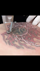 Laserxx Laser Tattoo Removal