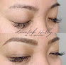 Luxeink Laser Tattoo Removal
