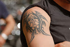 Madison Laser Tattoo Removal Laser Tattoo Removal