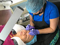 Microart Laser Tattoo Removal