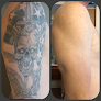 Moran Laser And Salon Laser Tattoo Removal