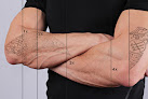 Mountain Island Skin Care Laser Tattoo Removal