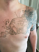 New Skin Centre Laser Tattoo Removal