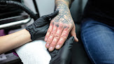 No Trace Lasers Laser Tattoo Removal