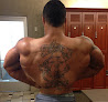 North Houston Laser Tattoo Removal Laser Tattoo Removal