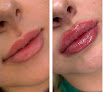 Noydeen Med Spa Of Conway Arkansas Laser Tattoo Removal