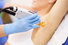 Oak Brook Laser Center Laser Tattoo Removal