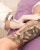 Ogden Skin Care Laser Tattoo Removal