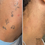 Pamper Me Pretty Aesthetics, Llc Laser Tattoo Removal