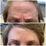 Prolase Medispa - Fairfax Laser Tattoo Removal
