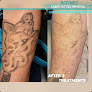 Refined Laser Tattoo Removal & Aesthetics Laser Tattoo Removal