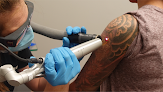 Removery Tattoo Removal & Fading Laser Tattoo Removal