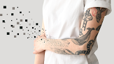 Removery Tattoo Removal & Fading Laser Tattoo Removal