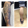 Removery Tattoo Removal & Fading Laser Tattoo Removal