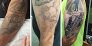 Removery Tattoo Removal & Fading Laser Tattoo Removal