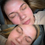 Restorative Wellness & Aesthetics Laser Tattoo Removal